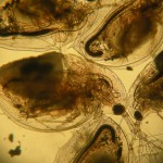 Little daphnia under a microscope. Photo credit: Daphnies by Thomas Bresson (license)